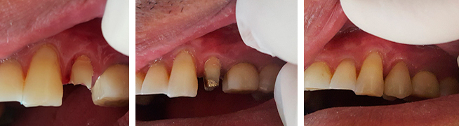 odontogeriatria odontogeriatria