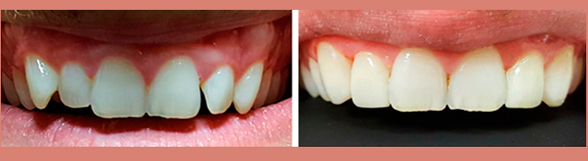 Endodontia no Brooklin Endodontia no Brooklin