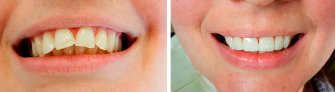 Harmonização facial Harmonização facial