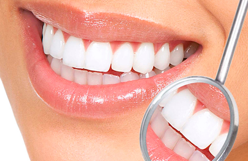 Lipo de papada Lipo de papada